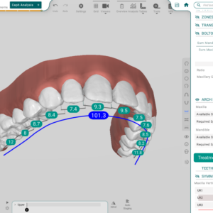 TitanDental_image