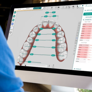 TitanDental_image2