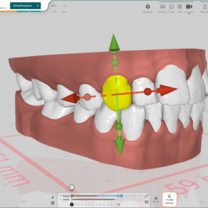 TitanDental_image3
