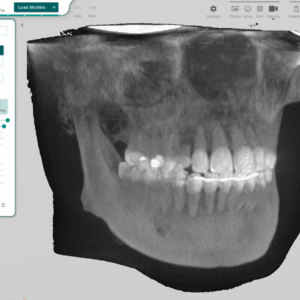 TitanDental_image4