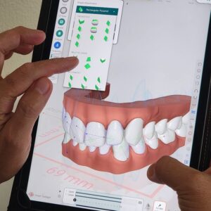 TitanDental_image5