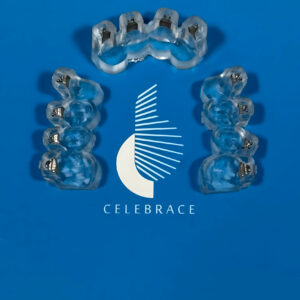 CelebraceBracketsBlue